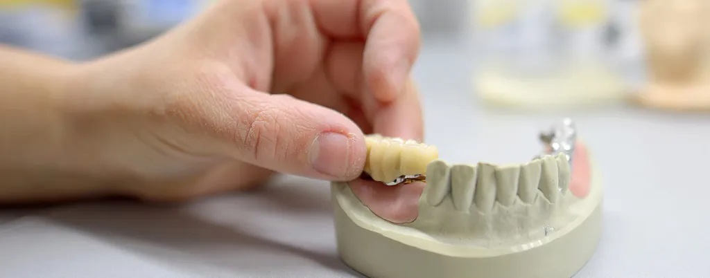 Hands holding a dental bridge on a model