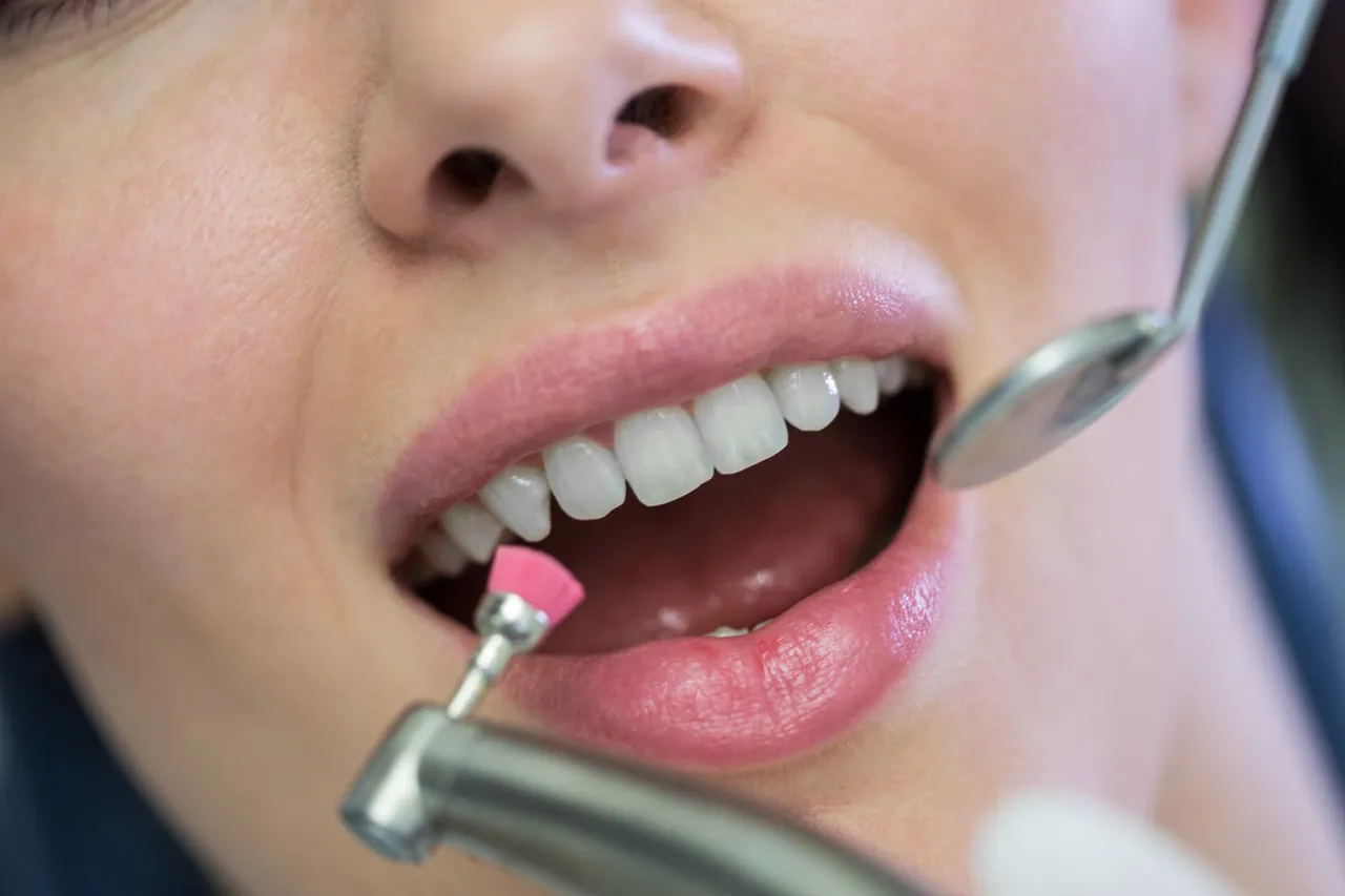 Close-up of teeth being polished with a dental tool