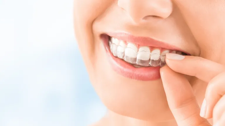 Orthodontics Invisalign Al Rigga