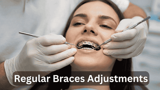 Affordable Braces