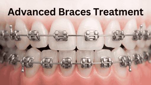 Affordable Orthodontic Treatment Dubai