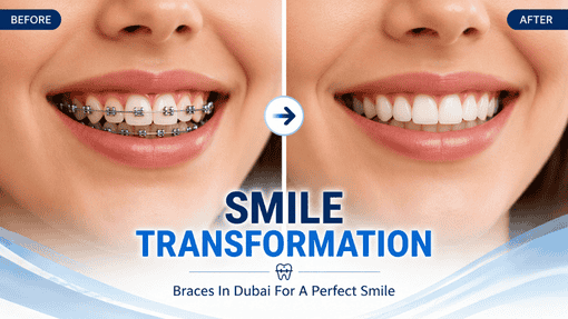 Best Braces Doctors in Dubai