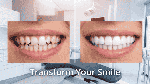 Expert Braces Doctors Near Deira