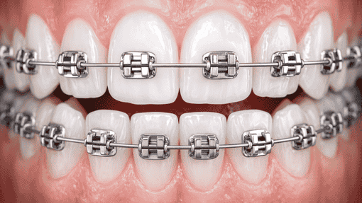 Why Easy Dental Clinic