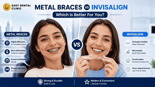 Ceramic braces are the best for adults