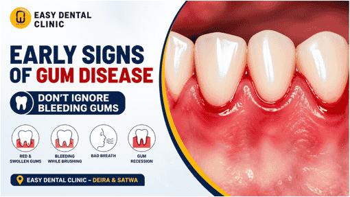 Don't Ignore Your Gums