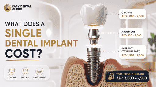 a Single Dental Implant Cost in Dubai