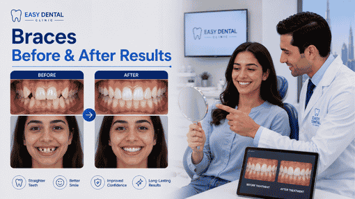 Finding the Best Braces Clinic Near Me in Dubai