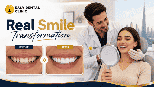 Smile Makeover In Dubai Cost — What to Expect
