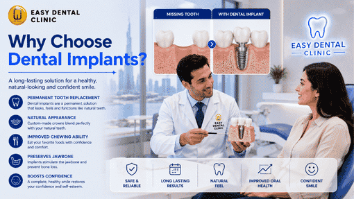 Why So Many People in Deira Are Choosing Dental Implants