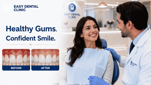 Advanced periodontics